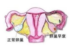 输卵管阻塞会构成什么样的危害?